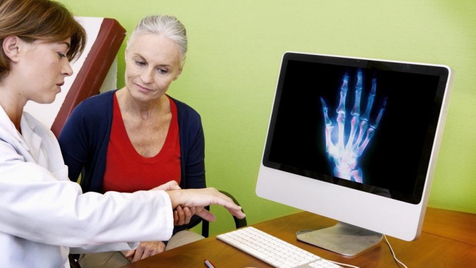 Woman with a doctor going over a bone scan of her hand.
